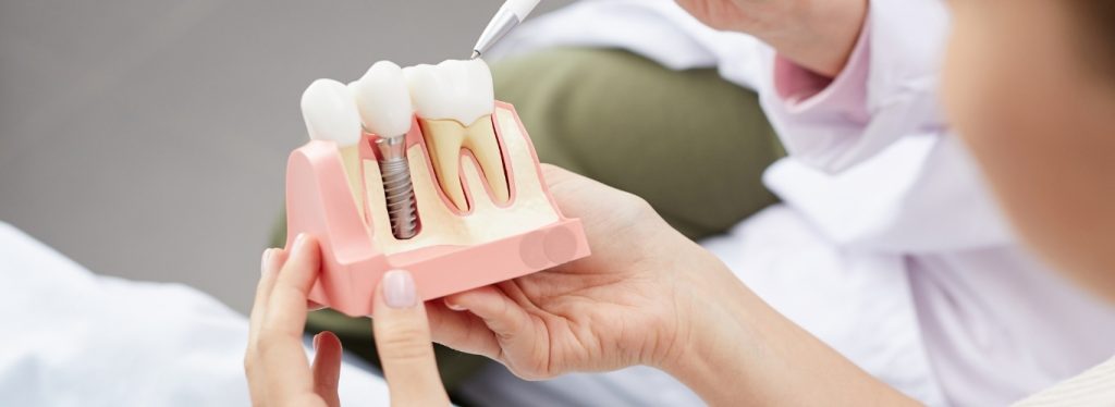 rh-smile-clinic-clinica-de-argoncilhe-17