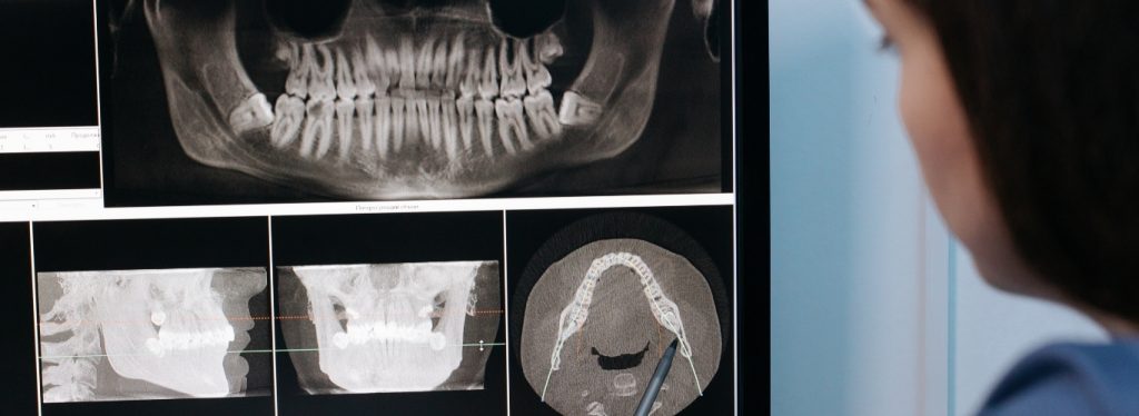 rh-smile-clinic-clinica-de-argoncilhe-32