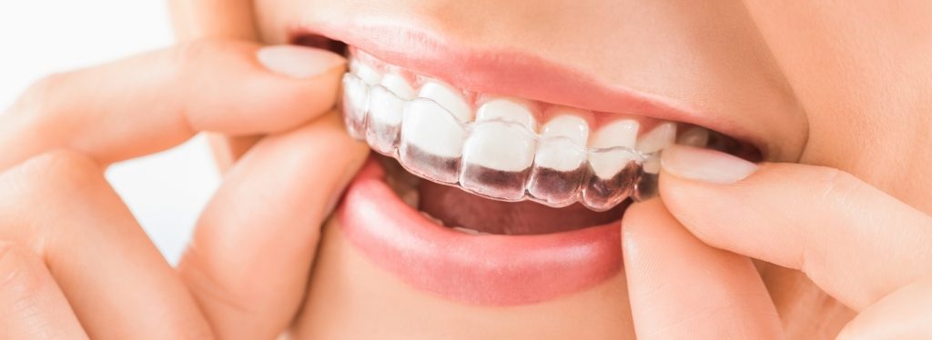 rh-smile-clinic-clinica-de-argoncilhe-308